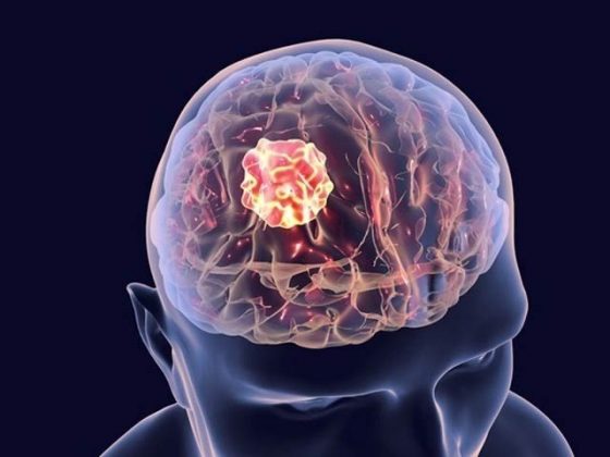 دماغی سرطان کو روکنے والی ویکسین پہلے طبی مرحلے میں کامیاب