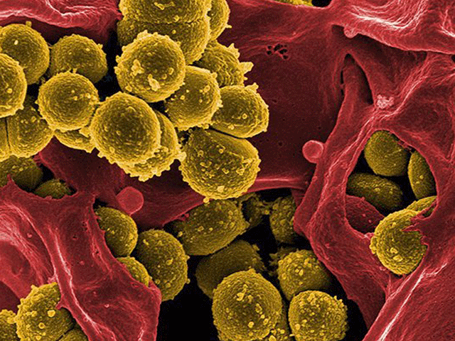 خطرناک ترین بیکٹیریا کے خلاف نیا ہتھیار، سونے کے ذرات